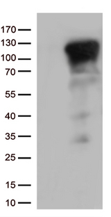 NFKB1 / NF-Kappa-B Antibody - HEK293T cells were transfected with the pCMV6-ENTRY control. (Left lane) or pCMV6-ENTRY NFKB1. (Right lane) cDNA for 48 hrs and lysed. Equivalent amounts of cell lysates. (5 ug per lane) were separated by SDS-PAGE and immunoblotted with anti-NFKB1. (1:500)