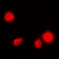 NFKB1 / NF-Kappa-B Antibody - Immunofluorescent analysis of NF-kappaB p105/p50 staining in NIH3T3 cells. Formalin-fixed cells were permeabilized with 0.1% Triton X-100 in TBS for 5-10 minutes and blocked with 3% BSA-PBS for 30 minutes at room temperature. Cells were probed with the primary antibody in 3% BSA-PBS and incubated overnight at 4 C in a humidified chamber. Cells were washed with PBST and incubated with a DyLight 594-conjugated secondary antibody (red) in PBS at room temperature in the dark. DAPI was used to stain the cell nuclei (blue).