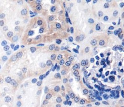 NFKB1 / NF-Kappa-B Antibody - Immunohistochemistry: NFkB p105 Antibody - IHC of NFKB in mouse kidney using DAB with hematoxylin counterstain.  This image was taken for the unconjugated form of this product. Other forms have not been tested.