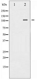 NFKB1 / NF-Kappa-B Antibody - Western blot of NF-kappaB p105/p50 expression in TNF-a treated HeLa whole cell lysates,The lane on the left is treated with the antigen-specific peptide.