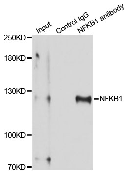 NFKB1 / NF-Kappa-B Antibody - Immunoprecipitation analysis of 150ug extracts of MCF-7 cells using 3ug NFKB1 antibody. Western blot was performed from the immunoprecipitate using NFKB1 antibody at a dilition of 1:500.