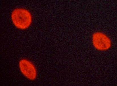 NFKB1 / NF-Kappa-B Antibody - Staining A549 cells by IF/ICC. The samples were fixed with PFA and permeabilized in 0.1% saponin prior to blocking in 10% serum for 45 min at 37°C. The primary antibody was diluted 1/400 and incubated with the sample for 1 hour at 37°C. A Alexa Fluor® 594 conjugated goat polyclonal to rabbit IgG (H+L), diluted 1/600 was used as secondary antibody.