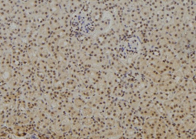 NFKB1 / NF-Kappa-B Antibody - 1:100 staining rat kidney tissue by IHC-P. The sample was formaldehyde fixed and a heat mediated antigen retrieval step in citrate buffer was performed. The sample was then blocked and incubated with the antibody for 1.5 hours at 22°C. An HRP conjugated goat anti-rabbit antibody was used as the secondary.