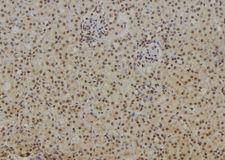 NFKB1 / NF-Kappa-B Antibody - 1:100 staining rat kidney tissue by IHC-P. The sample was formaldehyde fixed and a heat mediated antigen retrieval step in citrate buffer was performed. The sample was then blocked and incubated with the antibody for 1.5 hours at 22°C. An HRP conjugated goat anti-rabbit antibody was used as the secondary.