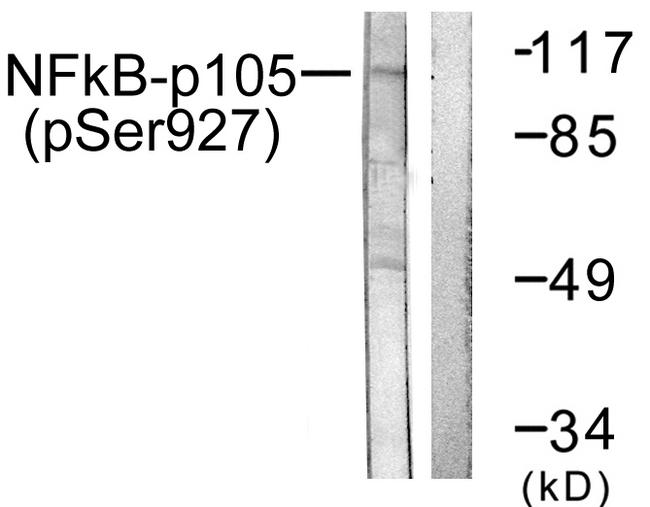 NFKB1 / NF-Kappa-B Antibody - Western blot analysis of extracts from Hela cells treated with TNF-a (20ng/ml, 5min), using NF-?B p105/p50 (Ab-927) antibody.