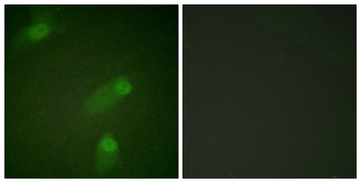 NFKB1 / NF-Kappa-B Antibody - Peptide - + Immunofluorescence analysis of HeLa cells, using NF-?B p105/p50 (Ab-927) antibody.