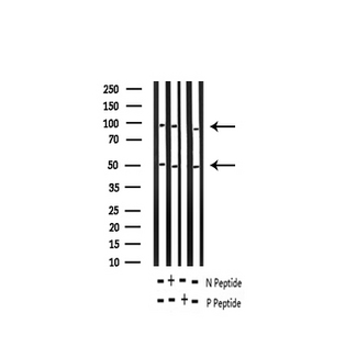 NFKB1 / NF-Kappa-B Antibody - Western blot analysis of Phospho-NF-kappaB p105/p50 (Ser337) expression in various lysates