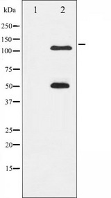 NFKB1 / NF-Kappa-B Antibody - Western blot analysis of NF-kappaB p105/p50 phosphorylation expression in MDA-MB-435 whole cells lysates. The lane on the left is treated with the antigen-specific peptide.