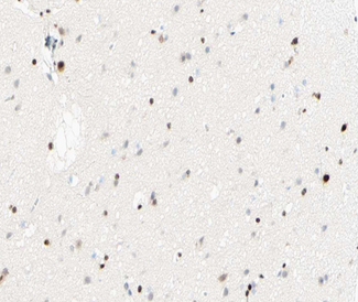 NFKB1 / NF-Kappa-B Antibody - 1:100 staining human brain tissue by IHC-P. The tissue was formaldehyde fixed and a heat mediated antigen retrieval step in citrate buffer was performed. The tissue was then blocked and incubated with the antibody for 1.5 hours at 22°C. An HRP conjugated goat anti-rabbit antibody was used as the secondary.