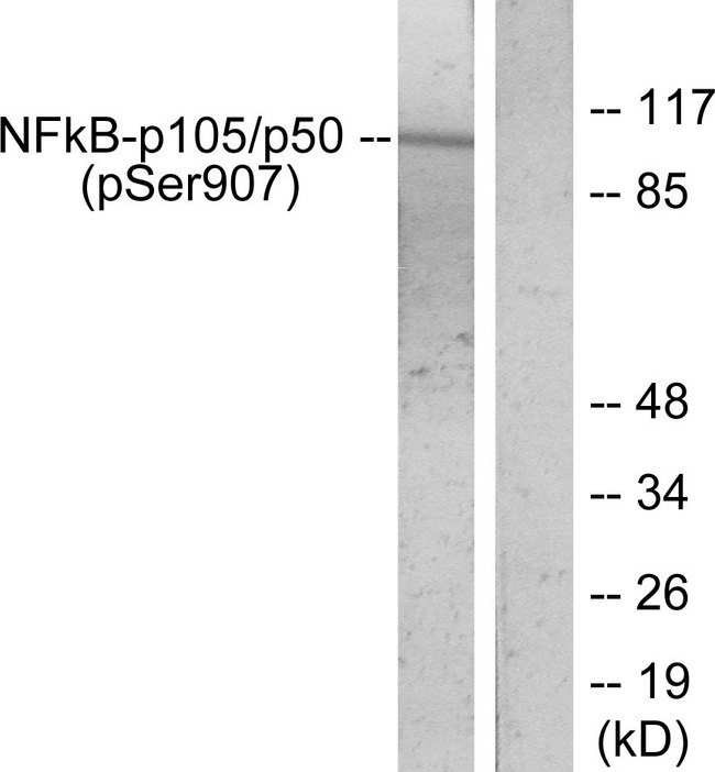 NFKB1 / NF-Kappa-B Antibody - Western blot analysis of lysates from HeLa cells treated with TNF-alpha, using NF-kappaB p105/p50 (Phospho-Ser907) Antibody. The lane on the right is blocked with the phospho peptide.