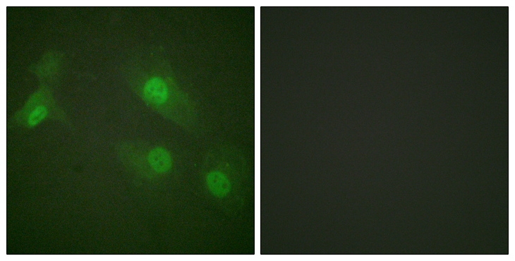 NFKB1 / NF-Kappa-B Antibody - Immunofluorescence analysis of HeLa cells treated with EGF 200nM 5', using NF-kappaB p105/p50 (Phospho-Ser927) Antibody. The picture on the right is blocked with the phospho peptide.