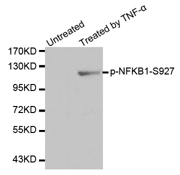 NFKB1 / NF-Kappa-B Antibody - Western blot analysis of extracts from HL60 cells.