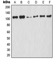 NFKB1 / NF-Kappa-B Antibody - Western blot analysis of NF-kappaB p105 (pS927) expression in HeLa UV-treated (A); A2780 (B); NIH3T3 (C); Raw264.7 TNFa-treated (D); rat liver (E); rat kidney (F) whole cell lysates.