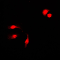 NFKB1 / NF-Kappa-B Antibody - Immunofluorescent analysis of NF-kappaB p105 (pS927) staining in HeLa cells. Formalin-fixed cells were permeabilized with 0.1% Triton X-100 in TBS for 5-10 minutes and blocked with 3% BSA-PBS for 30 minutes at room temperature. Cells were probed with the primary antibody in 3% BSA-PBS and incubated overnight at 4 C in a humidified chamber. Cells were washed with PBST and incubated with a DyLight 594-conjugated secondary antibody (red) in PBS at room temperature in the dark. DAPI was used to stain the cell nuclei (blue).