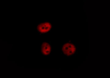 NFKB1 / NF-Kappa-B Antibody - Staining HeLa cells treated with EGF 200nM 5' cells by IF/ICC. The samples were fixed with PFA and permeabilized in 0.1% saponin prior to blocking in 10% serum for 45 min at 37°C. The primary antibody was diluted 1/400 and incubated with the sample for 1 hour at 37°C. A Alexa Fluor 594 conjugated goat polyclonal to rabbit IgG (H+L), diluted 1/600 was used as secondary antibody.