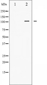 NFKB1 / NF-Kappa-B Antibody - Western blot analysis of NF-kappaB p105/p50 phosphorylation expression in LPS treated HeLa whole cells lysates. The lane on the left is treated with the antigen-specific peptide.