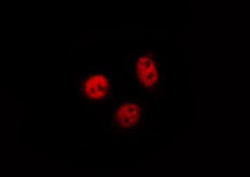 NFKB1 / NF-Kappa-B Antibody - Staining HeLa cells by IF/ICC. The samples were fixed with PFA and permeabilized in 0.1% Triton X-100, then blocked in 10% serum for 45 min at 25°C. The primary antibody was diluted at 1:200 and incubated with the sample for 1 hour at 37°C. An Alexa Fluor 594 conjugated goat anti-rabbit IgG (H+L) Ab, diluted at 1/600, was used as the secondary antibody.