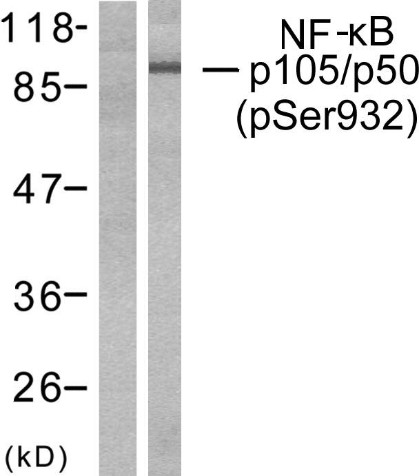 NFKB1 / NF-Kappa-B Antibody - Western blot analysis of lysates from HeLa cells treated with CA+TNF 20ng/ml 10', using NF-kappaB p105/p50 (Phospho-Ser932) Antibody. The lane on the left is blocked with the phospho peptide.