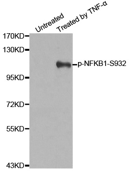 NFKB1 / NF-Kappa-B Antibody - Western blot analysis of extracts from 293 cells untreated or treated with TNF-a.