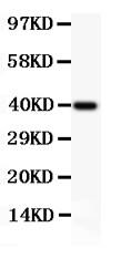 NFKB2 Antibody - NFkB p100 antibody Western blot. All lanes: Anti NFKBP100 at 0.5 ug/ml. WB: Recombinant Human NFKBP100 Protein 0.5ng. Predicted band size: 40 kD. Observed band size: 40 kD.