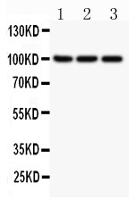 NFKB2 Antibody - NFkB p100 antibody Western blot. All lanes: Anti NFKBP100 at 0.5 ug/ml. Lane 1: JURKAT Whole Cell Lysate at 40 ug. Lane 2: A549 Whole Cell Lysate at 40 ug. Lane 3: MCF-7 Whole Cell Lysate at 40 ug. Predicted band size: 100 kD. Observed band size: 100 kD.