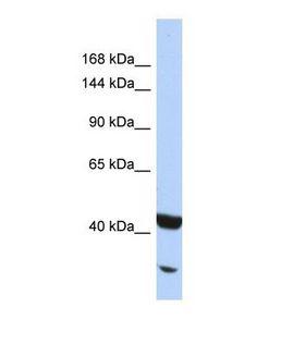 NFKB2 Antibody - Western blot of Human Jurkat. NFKB2 antibody dilution 1.0 ug/ml.  This image was taken for the unconjugated form of this product. Other forms have not been tested.
