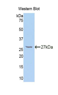 NFKB2 Antibody - Western blot of recombinant NFKB2.  This image was taken for the unconjugated form of this product. Other forms have not been tested.