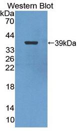 NFKB2 Antibody - Western blot of NFKB2 antibody.