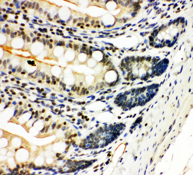 NFKB2 Antibody - NFKB2 antibody. IHC(P): Rat Intestine Tissue.