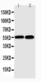 NFKB2 Antibody - WB of NFKB2 antibody. Lane 1: Mouse Liver Tissue Lysate. Lane 2: HEPA Cell Lysate.
