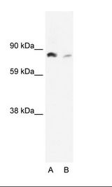 NFKB2 Antibody - A: Marker, B: Raji Cell Lysate.  This image was taken for the unconjugated form of this product. Other forms have not been tested.