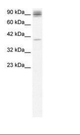 NFKB2 Antibody - Jurkat Cell Lysate.  This image was taken for the unconjugated form of this product. Other forms have not been tested.