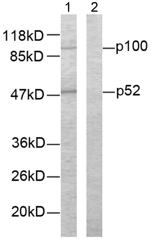 NFKB2 Antibody - Western blot analysis of lysates from ovary cancer cells, using NF-kappaB p100/p52 Antibody. The lane on the right is blocked with the synthesized peptide.