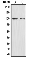 NFKB2 Antibody - Western blot analysis of NF-kappaB p100 expression in HEK293T (A); mouse liver (B) whole cell lysates.