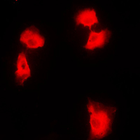 NFKB2 Antibody - Immunofluorescent analysis of NF-kappaB p100 staining in HEK293T cells. Formalin-fixed cells were permeabilized with 0.1% Triton X-100 in TBS for 5-10 minutes and blocked with 3% BSA-PBS for 30 minutes at room temperature. Cells were probed with the primary antibody in 3% BSA-PBS and incubated overnight at 4 C in a humidified chamber. Cells were washed with PBST and incubated with a DyLight 594-conjugated secondary antibody (red) in PBS at room temperature in the dark. DAPI was used to stain the cell nuclei (blue).