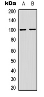 NFKB2 Antibody - Western blot analysis of NF-kappaB p100 (pS865) expression in HeLa (A); MCF7 (B) whole cell lysates.