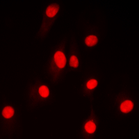 NFKB2 Antibody - Immunofluorescent analysis of NF-kappaB p100 (pS865) staining in HepG2 cells. Formalin-fixed cells were permeabilized with 0.1% Triton X-100 in TBS for 5-10 minutes and blocked with 3% BSA-PBS for 30 minutes at room temperature. Cells were probed with the primary antibody in 3% BSA-PBS and incubated overnight at 4 deg C in a humidified chamber. Cells were washed with PBST and incubated with a DyLight 594-conjugated secondary antibody (red) in PBS at room temperature in the dark. DAPI was used to stain the cell nuclei (blue).