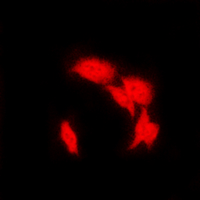 NFKB2 Antibody - Immunofluorescent analysis of NF-kappaB p100 staining in HeLa cells. Formalin-fixed cells were permeabilized with 0.1% Triton X-100 in TBS for 5-10 minutes and blocked with 3% BSA-PBS for 30 minutes at room temperature. Cells were probed with the primary antibody in 3% BSA-PBS and incubated overnight at 4 deg C in a humidified chamber. Cells were washed with PBST and incubated with a DyLight 594-conjugated secondary antibody (red) in PBS at room temperature in the dark. DAPI was used to stain the cell nuclei (blue).