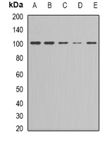 NFKB2 Antibody - Western blot analysis of NF-kappaB p100 expression in Jurkat (A); HeLa (B); HEK293T (C); HepG2 (D); K562 (E) whole cell lysates.
