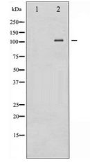 NFKB2 Antibody - Western blot of NF-kappaB p100/p52 expression in ovary cancer whole cell lysates,The lane on the left is treated with the antigen-specific peptide.