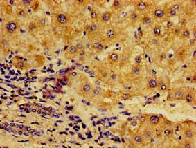 NFKB2 Antibody - Immunohistochemistry image of paraffin-embedded human liver tissue at a dilution of 1:100