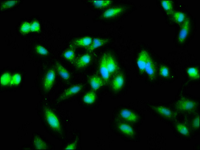 NFKB2 Antibody - Immunofluorescence staining of Hela cells with NFKB2 Antibody at 1:133, counter-stained with DAPI. The cells were fixed in 4% formaldehyde, permeabilized using 0.2% Triton X-100 and blocked in 10% normal Goat Serum. The cells were then incubated with the antibody overnight at 4°C. The secondary antibody was Alexa Fluor 488-congugated AffiniPure Goat Anti-Rabbit IgG(H+L).