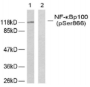 NFKB2 Antibody - Detection of NF?B-p100 (phospho-Ser866) in extract of human ovarian carcinoma cells.