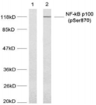 NFKB2 Antibody - Detection of NF?B-p100 (phospho-Ser870) in extract of MDA-MB-435 cells untreated or treated with TNFa.