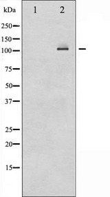 NFKB2 Antibody - Western blot analysis of NF-kappaB p100/p52 expression in ovary carcinoma whole cells lysates. The lane on the left is treated with the antigen-specific peptide.