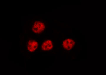 NFKB2 Antibody - Staining RAW264.7 cells by IF/ICC. The samples were fixed with PFA and permeabilized in 0.1% Triton X-100, then blocked in 10% serum for 45 min at 25°C. The primary antibody was diluted at 1:200 and incubated with the sample for 1 hour at 37°C. An Alexa Fluor 594 conjugated goat anti-rabbit IgG (H+L) Ab, diluted at 1/600, was used as the secondary antibody.
