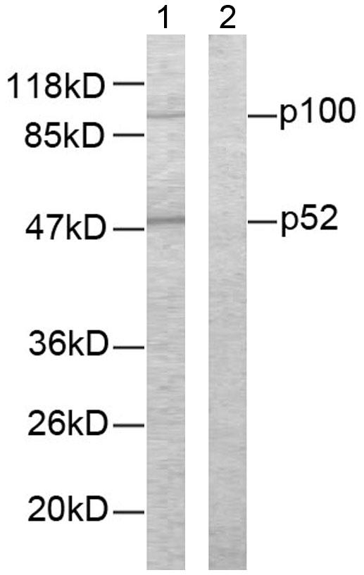 NFKB2 Antibody - Western blot analysis of extracts from ovary cancer cells. Line1: Using NF-?B p100/p52 (Ab-865) Antibody; Line2: The same antibody preincubated with synthesized peptide.