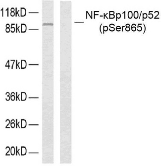 NFKB2 Antibody - Western blot analysis of lysates from ovary cancer, using NF-kappaB p100/p52 (Phospho-Ser865) Antibody. The lane on the left is blocked with the phospho peptide.