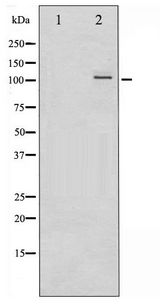 NFKB2 Antibody - Western blot of NF- kappaB p100/p52 phosphorylation expression in ovary cancer whole cell lysates,The lane on the left is treated with the antigen-specific peptide.
