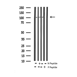 NFKB2 Antibody - Western blot analysis of Phospho-NF-kappaB p100/p52 (Ser865) expression in various lysates